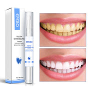 Tooth Whitening Pen – Oral Care